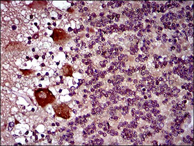 Immunohistochemical for Anti-DRP1/DNM1L Antibody (R2T47) ?>
