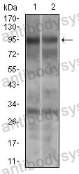 Western blot for Anti-DRP1/DNM1L Antibody (R2T47) ?>