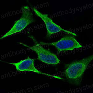 Immunofluorescence for Anti-DRP1/DNM1L Antibody (R2T48) ?>