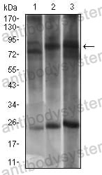 Western blot for Anti-DRP1/DNM1L Antibody (R2T48) ?>