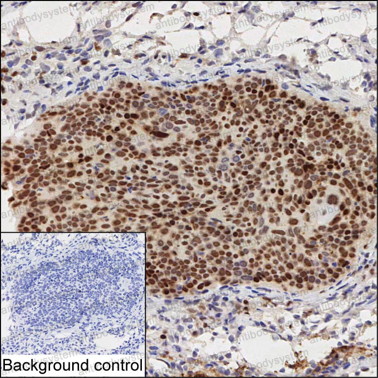 Immunohistochemical for Anti-IFRD1 Antibody (R2T50) ?>