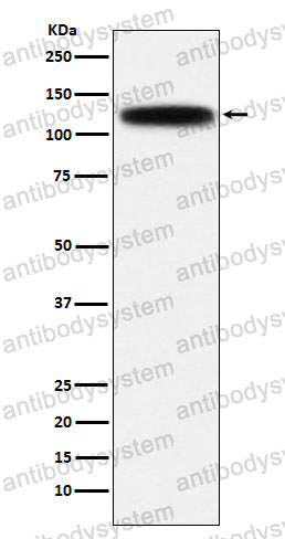 Anti-GOLIM4 Antibody (R1C90)