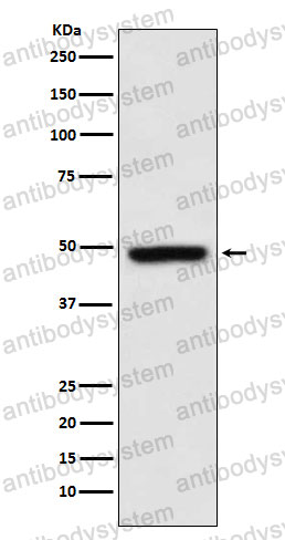 Anti-MEIS1 Antibody (R1C91)