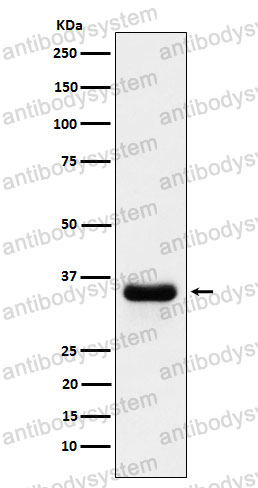 Anti-PSMD14 Antibody (R1C93)