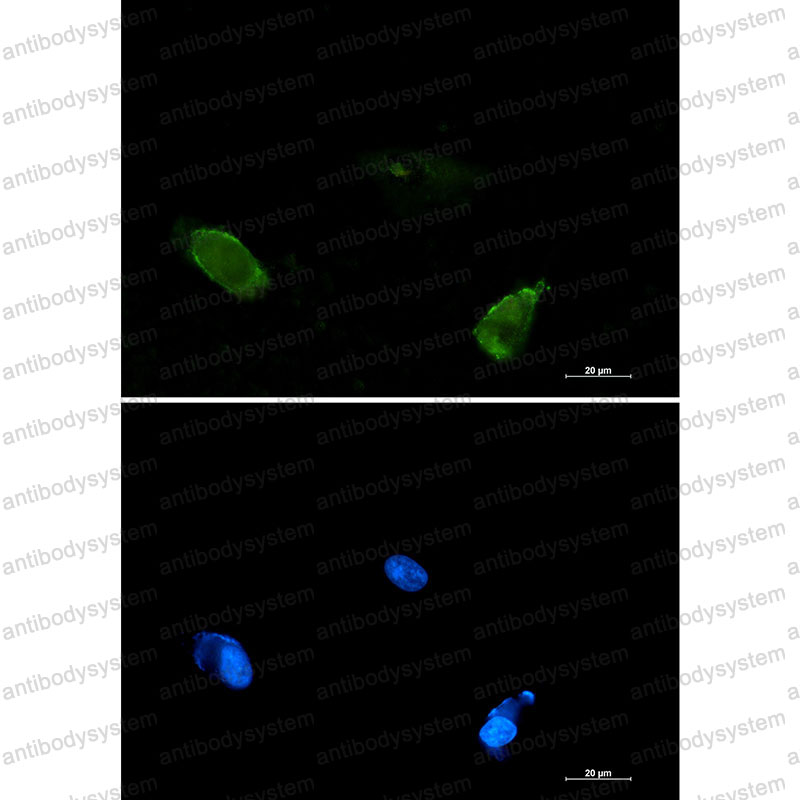 Anti-BIN1 Antibody (R1C94)