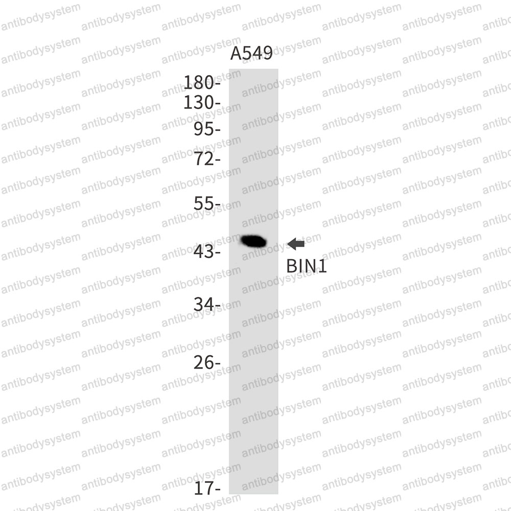 Anti-BIN1 Antibody (R1C95)