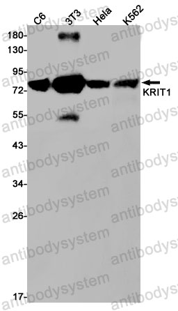 Anti-KRIT1 Antibody (R1C98)