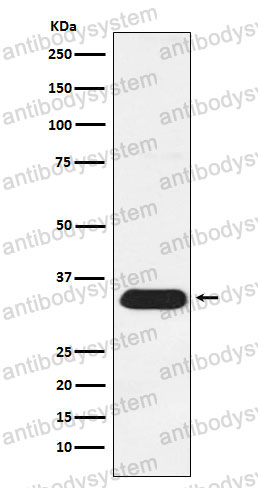 Anti-SDCBP Antibody (R1C99)