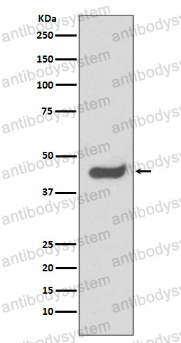 Anti-SOX1 Antibody (R1D01)