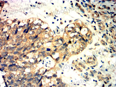 Immunohistochemical for Anti-PODXL Antibody (R2T62) ?>