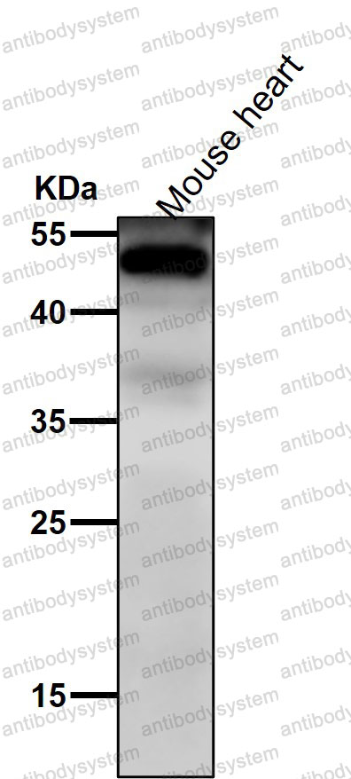 Anti-NFIB/NF1B2 Antibody (R1D03)