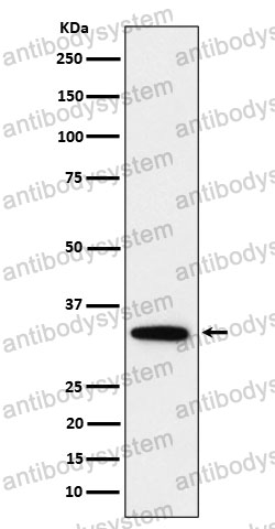 Anti-PPP6C Antibody (R1D05)