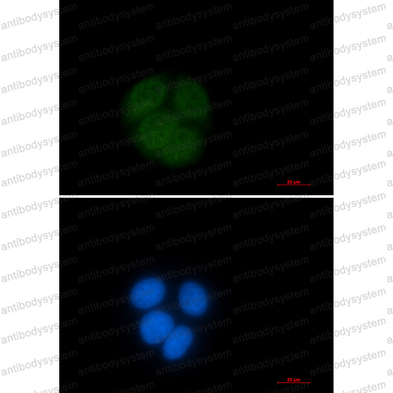Anti-UBE2C Antibody (R1D06)
