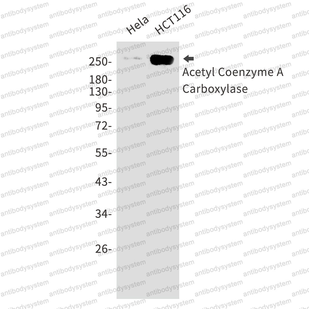 Anti-ACACB Antibody (R1D08)