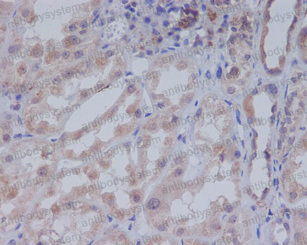 Anti-ACACB Antibody (R1D07)