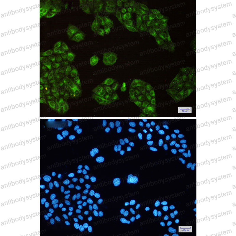Anti-SCD Antibody (R1D09)