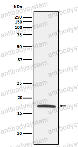 Anti-CLDN4/Claudin-4 Antibody (R1D10)