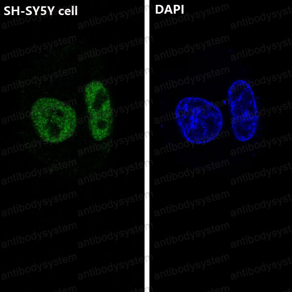 Anti-ARID1A Antibody (R1D11)