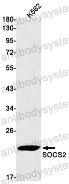 Anti-SOCS2 Antibody (R1D13)