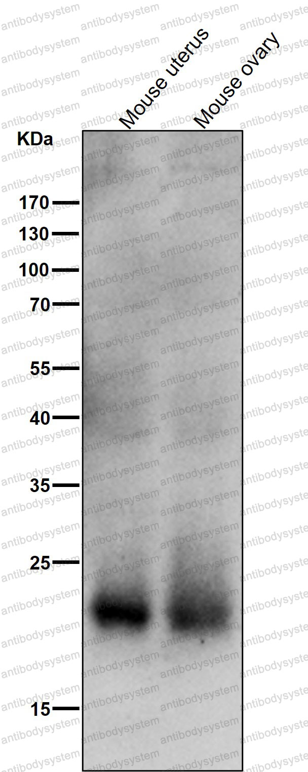 Anti-SOCS2 Antibody (R1D12)