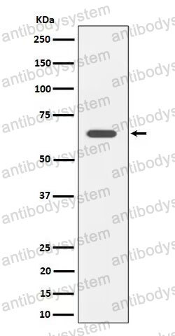 Anti-SOCS7 Antibody (R1D14)