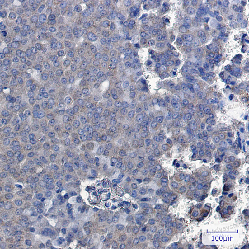 Anti-TXNDC9 Antibody (R1D15)