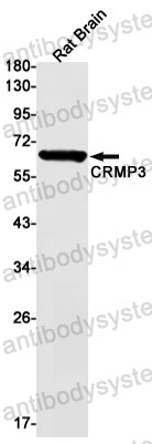 Anti-DPYSL4 Antibody (R1D17)