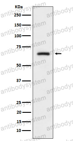 Anti-DPYSL4 Antibody (R1D16)