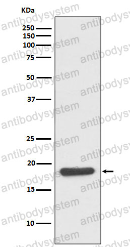 Anti-HSPB6 Antibody (R1D18)