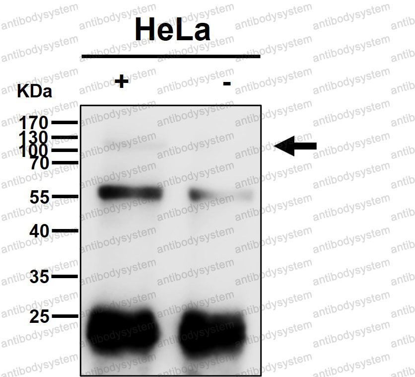 Anti-NCAN Antibody (R1D19)