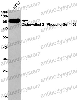 Anti-Phospho-DVL2 (Ser143) Antibody (R1D21)