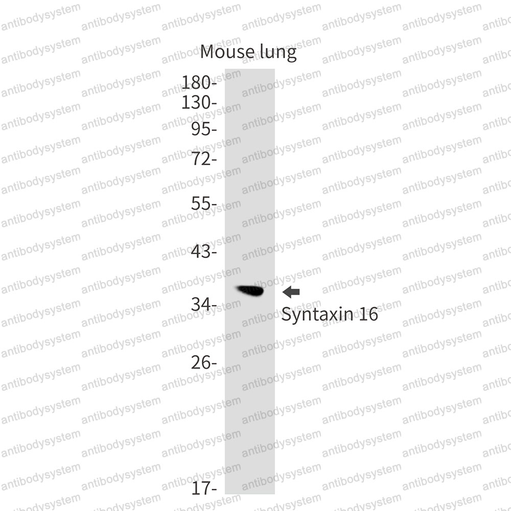 Anti-STX16 Antibody (R1D23)