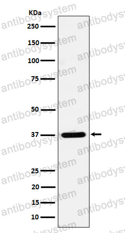 Anti-STX16 Antibody (R1D22)