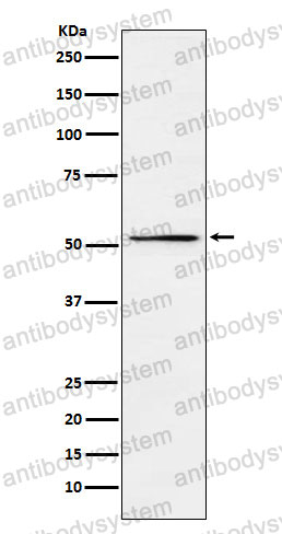 Anti-MEIS2 Antibody (R1D27)