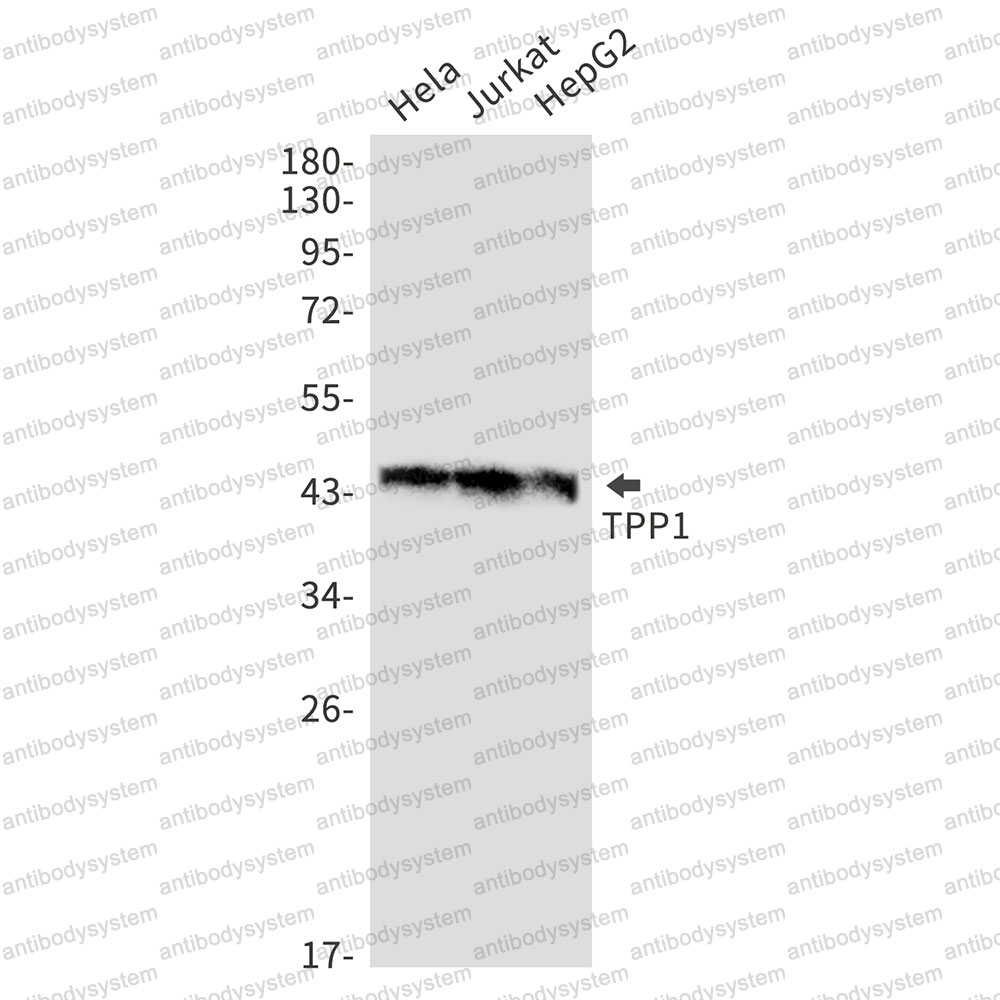 Anti-TPP1 Antibody (R1D28)
