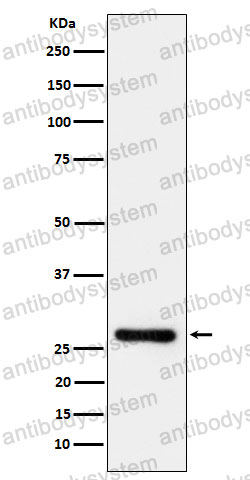 Anti-CD263/TNFRSF10C Antibody (R1B70)