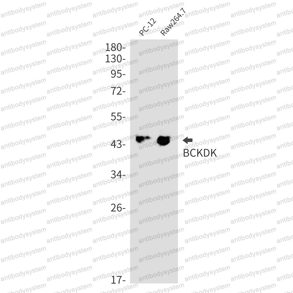 Anti-BCKDK Antibody (R1D32)