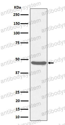 Anti-BCKDK Antibody (R1D31)