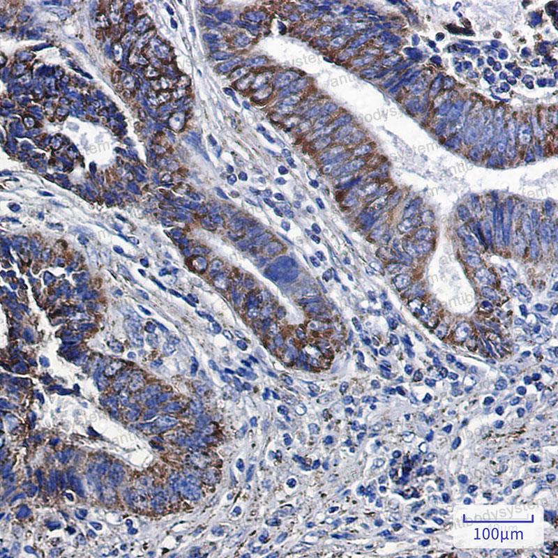 Anti-MGST3 Antibody (R1D33)