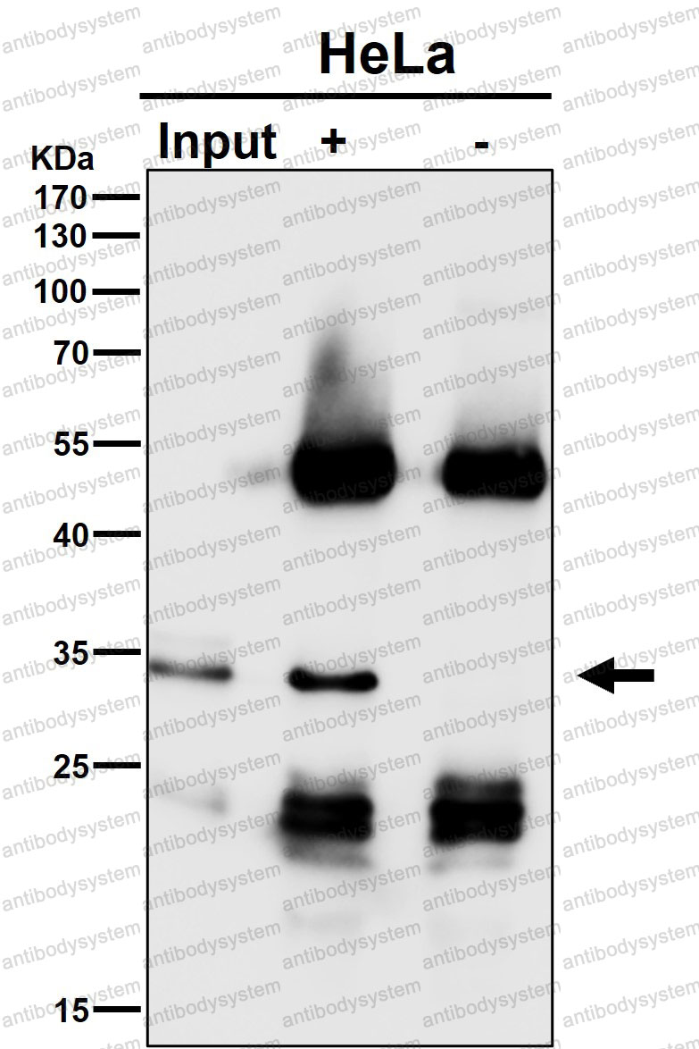 Anti-GEMIN2 Antibody (R1D34)