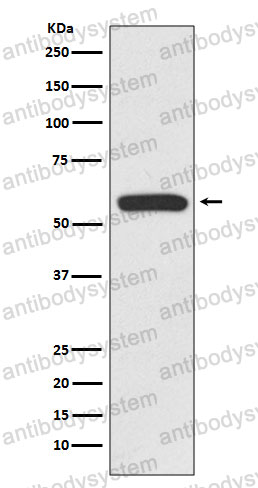 Anti-IRF6 Antibody (R1D35)