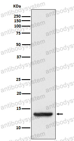 Anti-TAX1BP3 Antibody (R1D36)