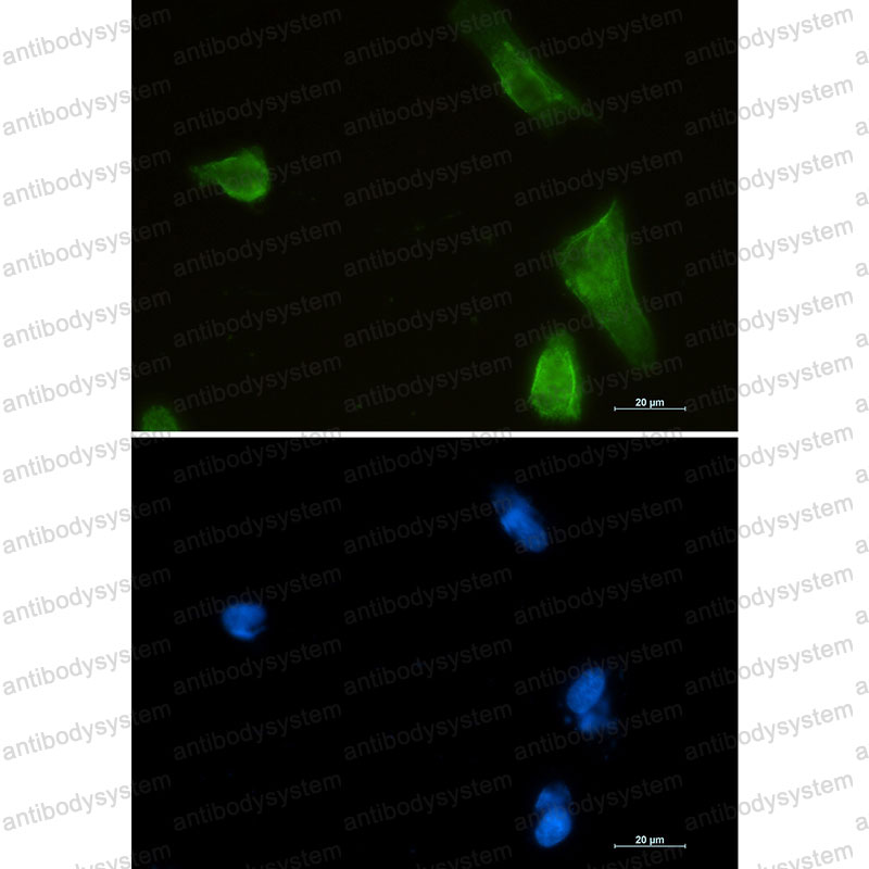 Anti-IKBKB Antibody (R1D37)