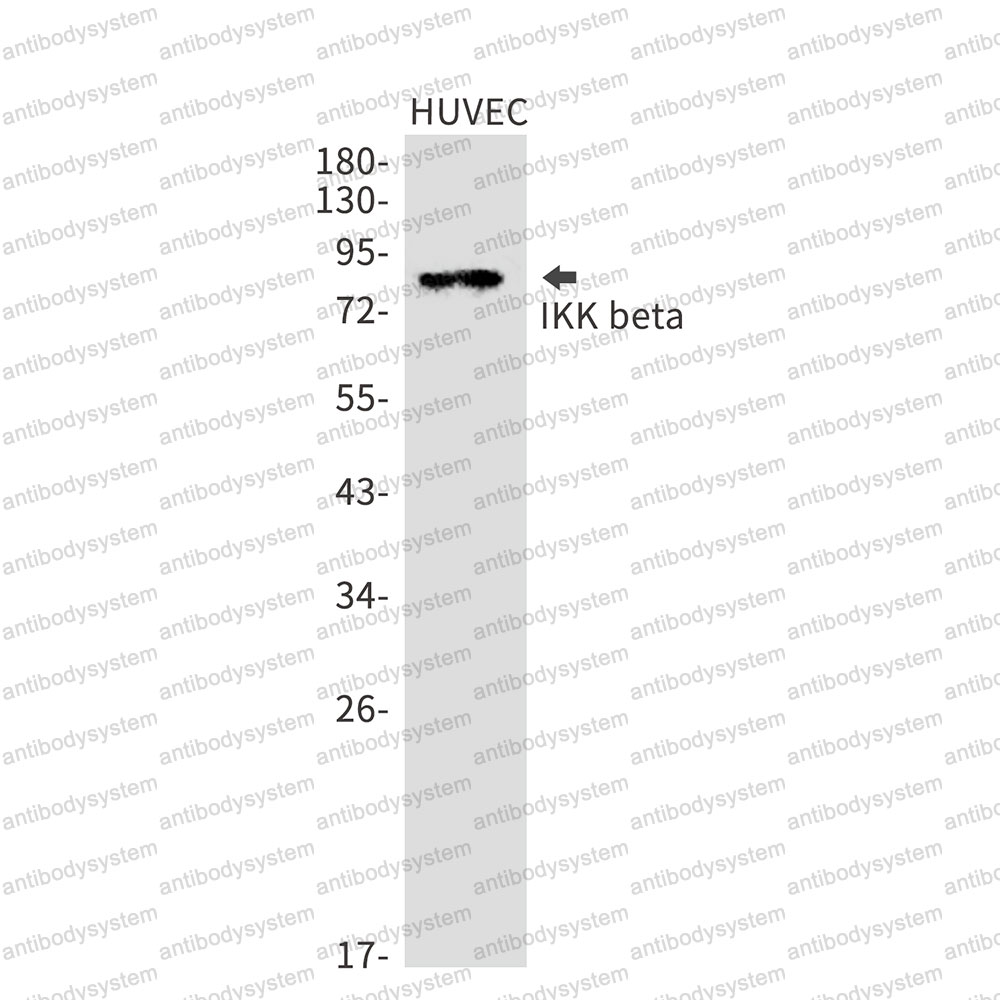 Anti-IKBKB Antibody (R1D38)