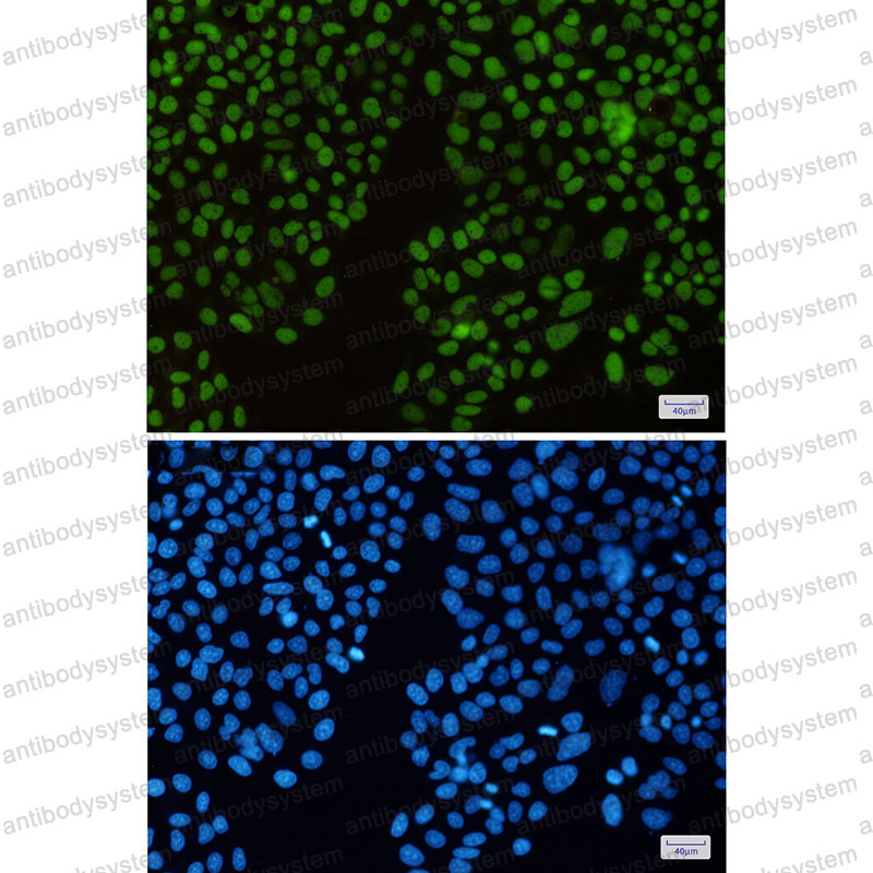 Anti-HAT1 Antibody (R1D41)