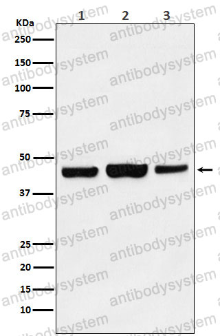 Anti-KAT1/HAT1 Antibody (R1D39)