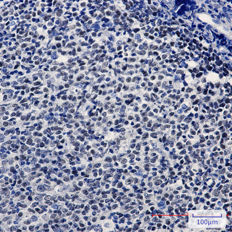 Anti-HAT1 Antibody (R1D40)