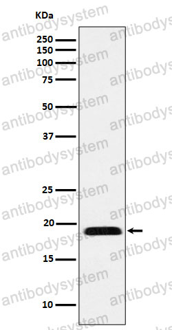 Anti-MYL12B Antibody (R1D42)