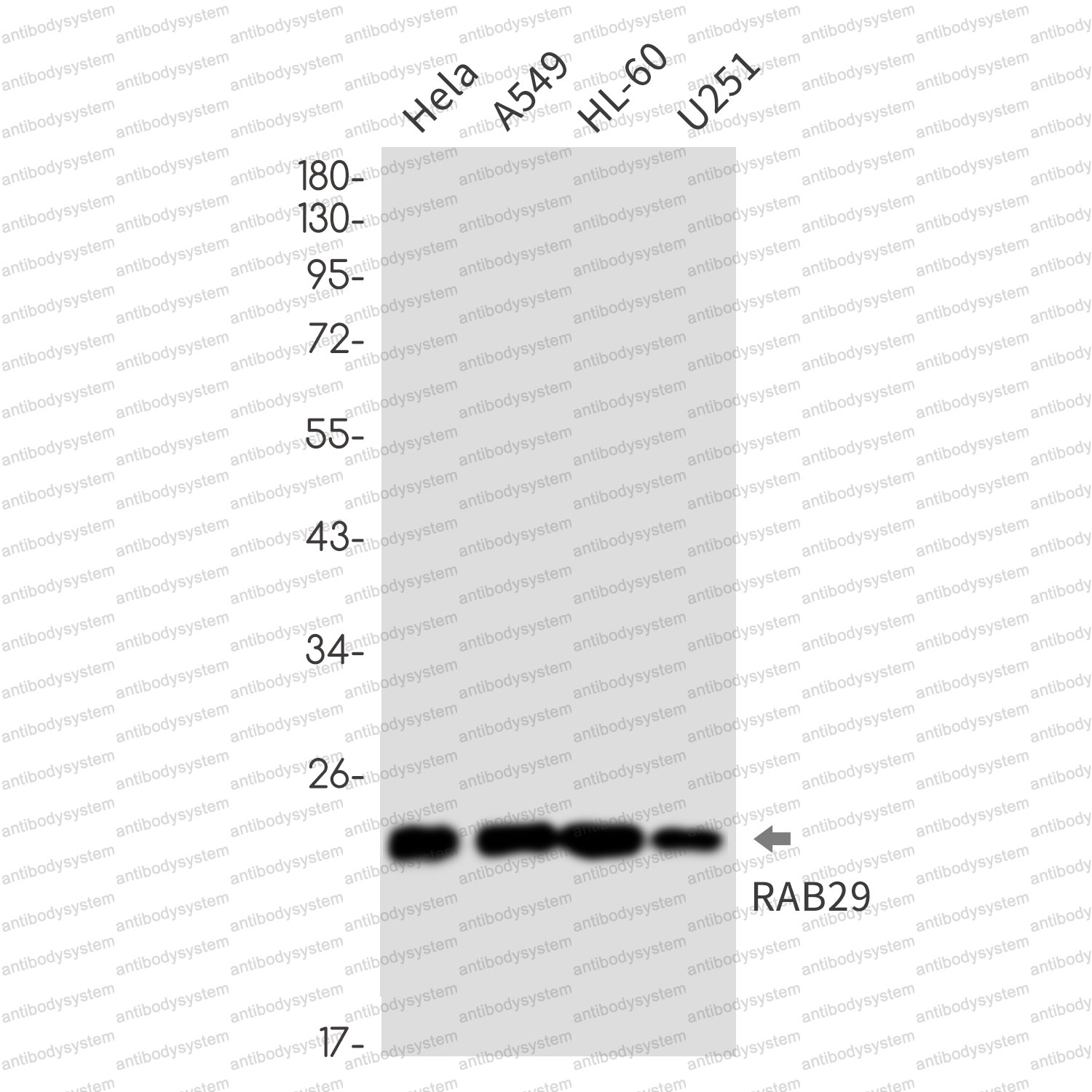 Anti-RAB29 Antibody (R1D43)