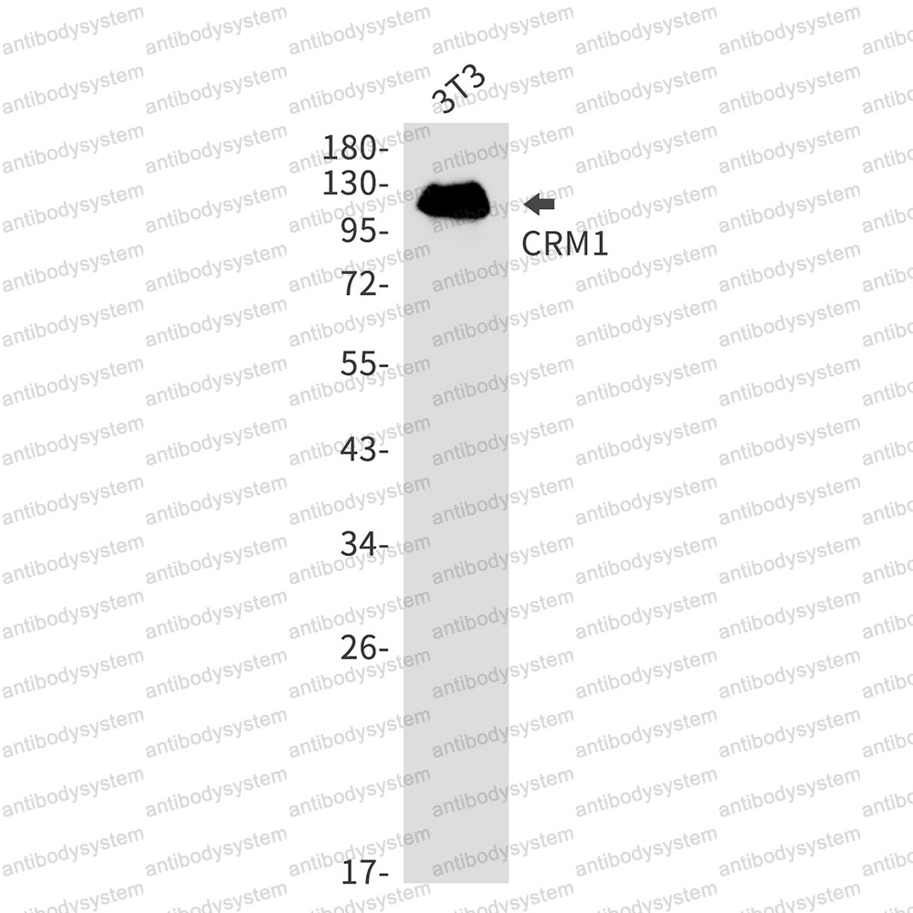 Anti-XPO1 Antibody (R1D45)
